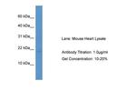 HSPB7 Antibody in Western Blot (WB)