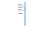 ZNF19 Antibody in Western Blot (WB)