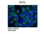 CPT1A Antibody in Immunohistochemistry (IHC)