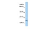 METTL10 Antibody in Western Blot (WB)