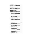 METTL11B Antibody in Western Blot (WB)