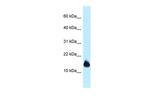 1110059E24Rik Antibody in Western Blot (WB)