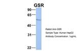 GSR Antibody in Western Blot (WB)