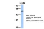 GSR Antibody in Western Blot (WB)