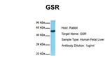 GSR Antibody in Western Blot (WB)