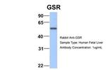 GSR Antibody in Western Blot (WB)