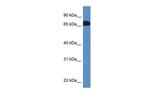 Protein S Antibody in Western Blot (WB)