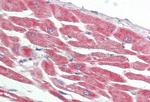 PKA alpha Antibody in Immunohistochemistry (Paraffin) (IHC (P))