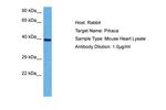 PKA alpha Antibody in Western Blot (WB)