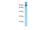 AACS Antibody in Western Blot (WB)