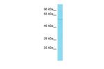 PDZD7 Antibody in Western Blot (WB)