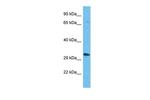 OR5AP2 Antibody in Western Blot (WB)