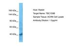 TBC1D9B Antibody in Western Blot (WB)