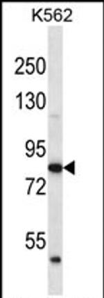 ABTB2 Antibody in Western Blot (WB)