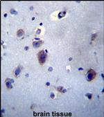 PRLH Antibody in Immunohistochemistry (Paraffin) (IHC (P))