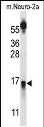 PRLH Antibody in Western Blot (WB)