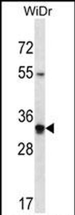 OR2W5 Antibody in Western Blot (WB)