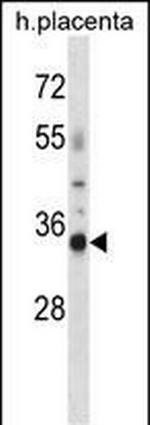 OR4K13 Antibody in Western Blot (WB)