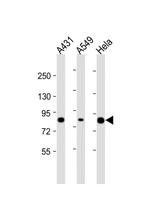 PLA2G4D Antibody in Western Blot (WB)