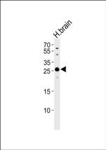 MOG Antibody in Western Blot (WB)