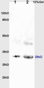 BAMBI Antibody in Western Blot (WB)