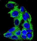 ACADM Antibody in Immunocytochemistry (ICC/IF)