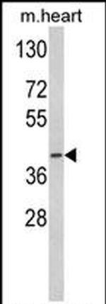 ACADM Antibody in Western Blot (WB)