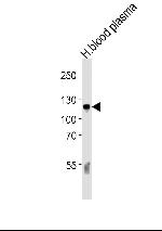 Complement C6 Antibody in Western Blot (WB)