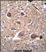 ITPKB Antibody in Immunohistochemistry (IHC)