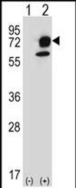 ITPKB Antibody in Western Blot (WB)