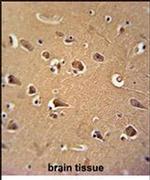 Calmodulin 1 Antibody in Immunohistochemistry (IHC)