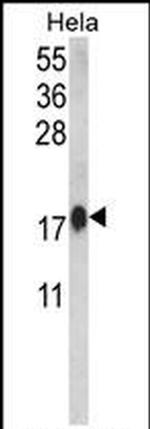 Calmodulin 1 Antibody in Western Blot (WB)