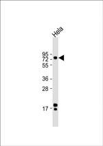 ATF6 Antibody in Western Blot (WB)