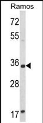 ACY3 Antibody in Western Blot (WB)