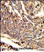 p41-ARCb Antibody in Immunohistochemistry (IHC)