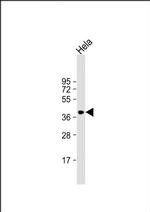 p41-ARCb Antibody in Western Blot (WB)