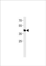 TFAP2E Antibody in Western Blot (WB)