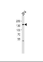 PKN2 Antibody in Western Blot (WB)