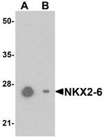 Nkx2.6 Antibody in Western Blot (WB)