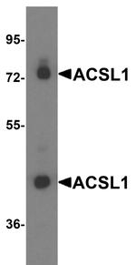 ACSL1 Antibody in Western Blot (WB)