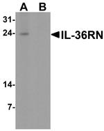 IL1F5 Antibody in Western Blot (WB)