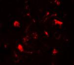 TET1 Antibody in Immunohistochemistry (Paraffin) (IHC (P))