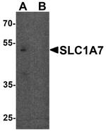 SLC1A7 Antibody in Western Blot (WB)