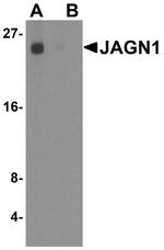 JAGN1 Antibody in Western Blot (WB)
