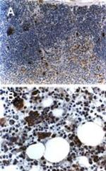 TRAF5 Antibody in Immunohistochemistry (Paraffin) (IHC (P))