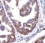 NBR1 Antibody in Immunohistochemistry (Paraffin) (IHC (P))