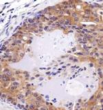 FAT4 Antibody in Immunohistochemistry (Paraffin) (IHC (P))