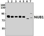 NYREN18 Antibody in Western Blot (WB)