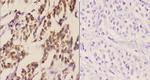 C/EBP delta/epsilon Antibody in Immunohistochemistry (Paraffin) (IHC (P))