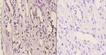 YBX2 Antibody in Immunohistochemistry (Paraffin) (IHC (P))